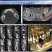 В поликлинике проводится цифровое 3D обследование челюстей