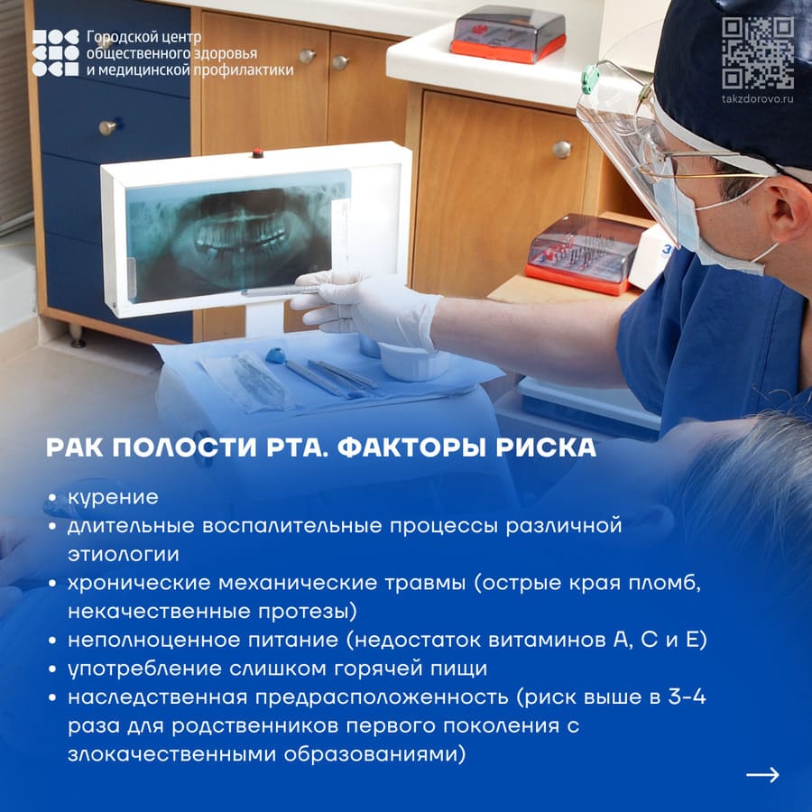 Рак полости рта, факторы риска